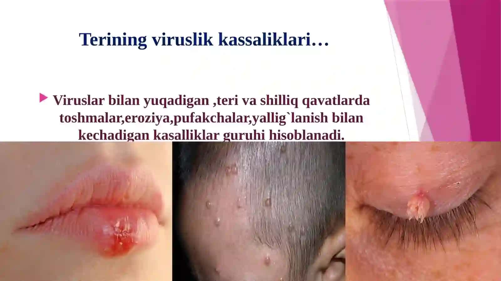 Viruslik kassaliklar 2