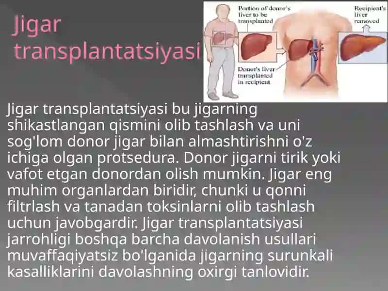 JIGAR TRANSPLANTOLOGIYASI 2