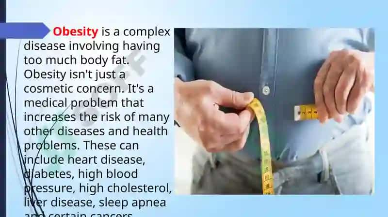 Obesity Treatment at Tashkent Medical Academy 2