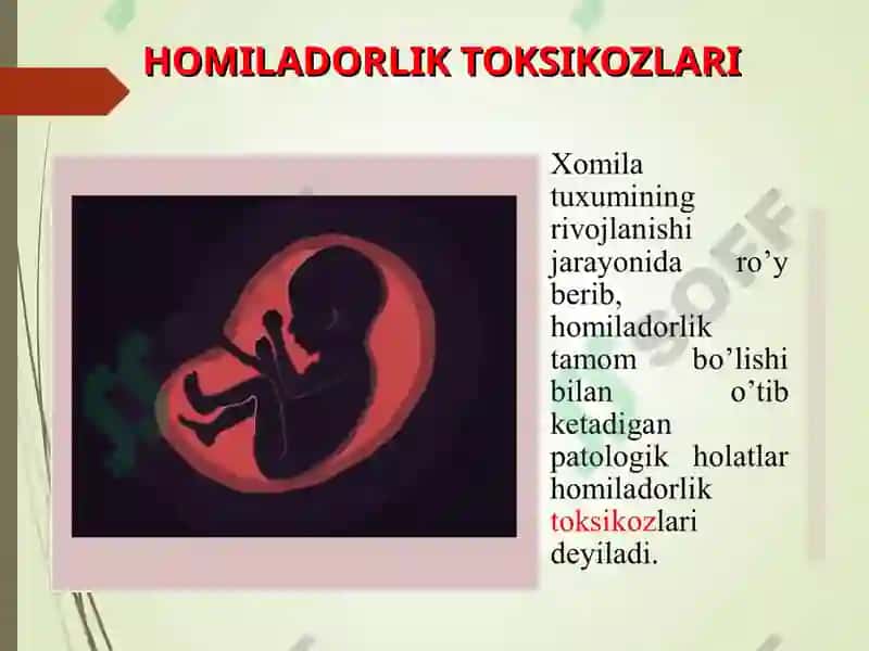 Homiladorlik ilk toksikozlari 2