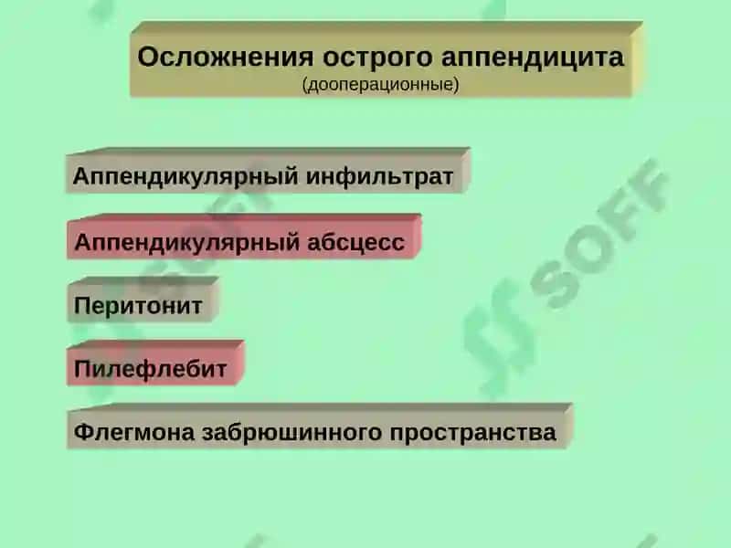 Осложнения острого аппендицита 2