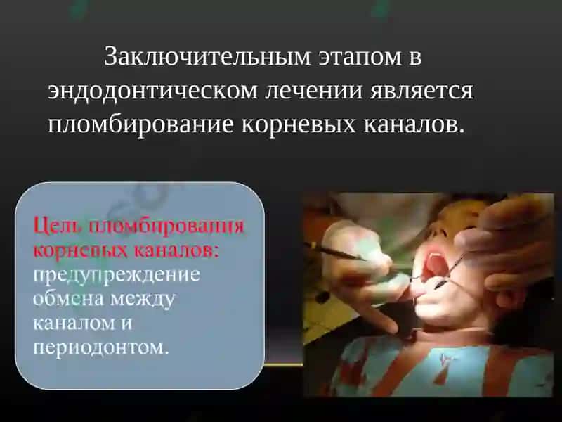 МАТЕРИАЛЫ ДЛЯ ПЛОМБИРОВАНИЯ КОРНЕВЫХ КАНАЛОВ 2
