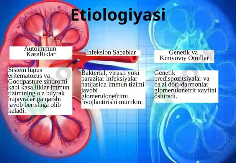Glomerulonefrit: Buyrak Yallig'lanishi 2