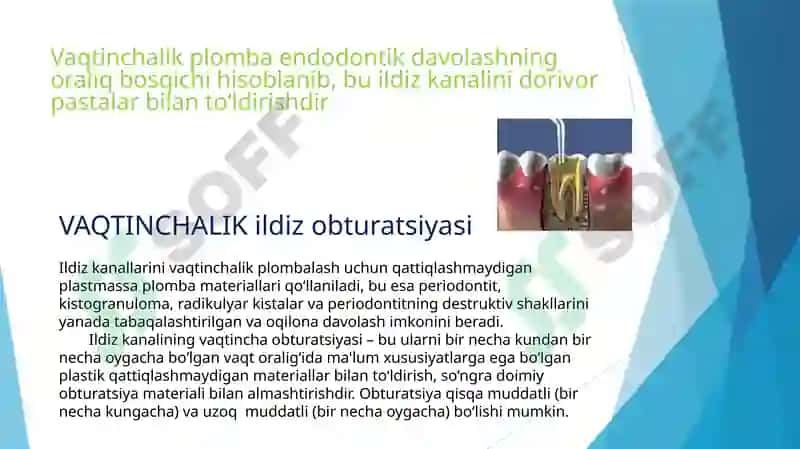 Kanalga vaqtinchalik plomba qoʻyish 2