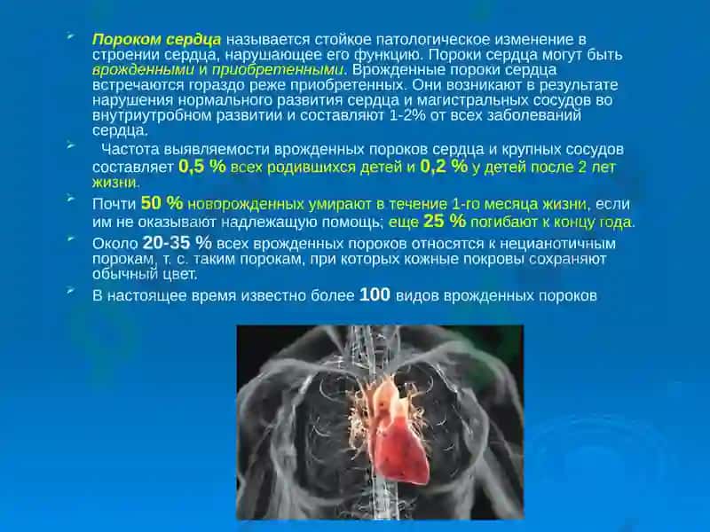 Врожденные пороки сердца 2