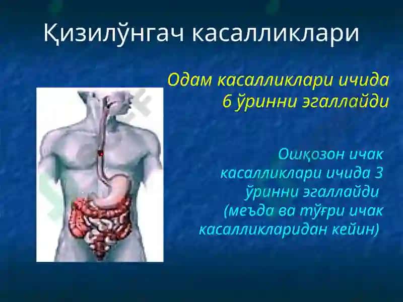 Қизилўнгач касалликлари 2