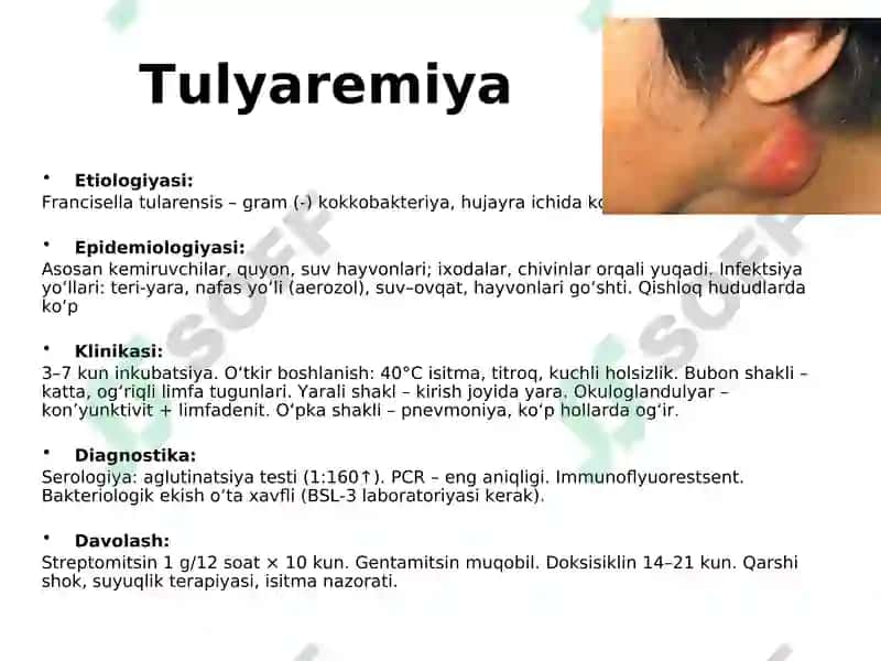 O‘ta hafli infeksiyalar 2