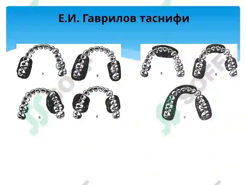 Таянч тишларга булган талаблар 2