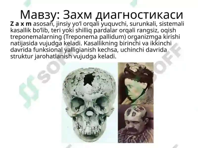 zaxm diagnostikasi - захм диагностикаси 2