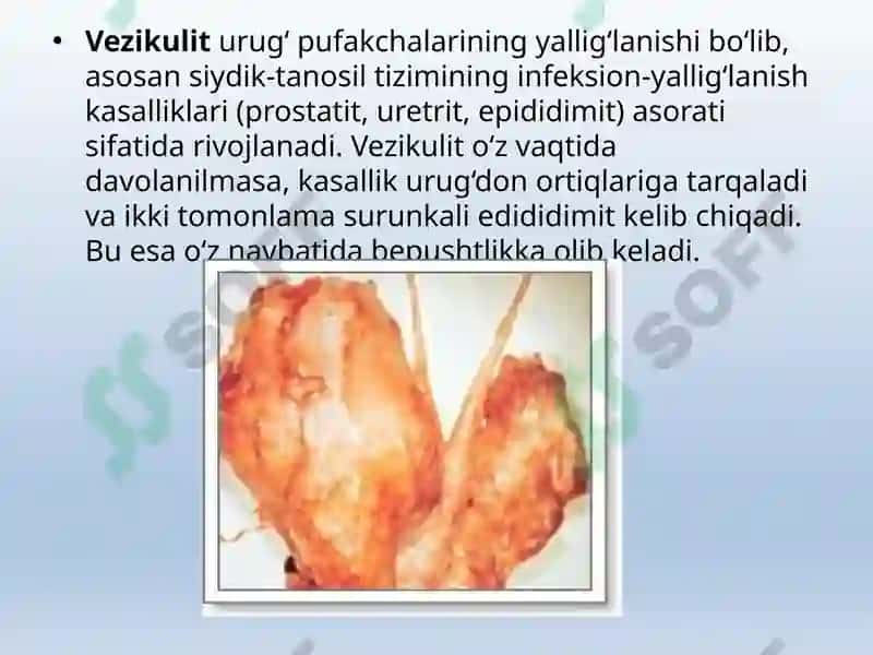 ERKAKLAR TANOSIL A`ZOLARI, AYOLLAR TANOSIL A`ZOLARI 2