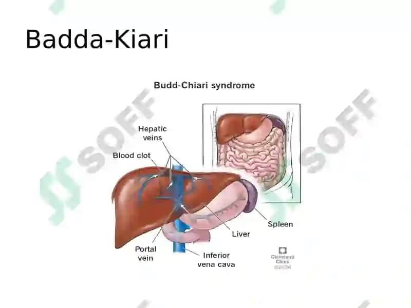 :Badda kiari va Vilson kanavalov 2