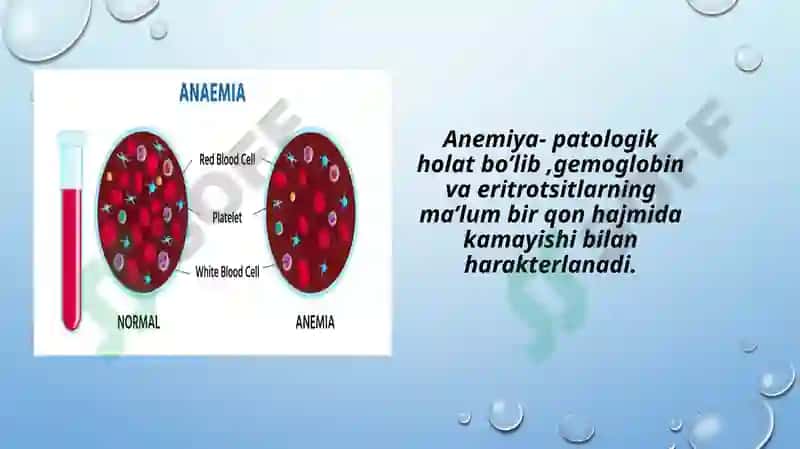 Surunkalikasalliklar anemiyasi 2