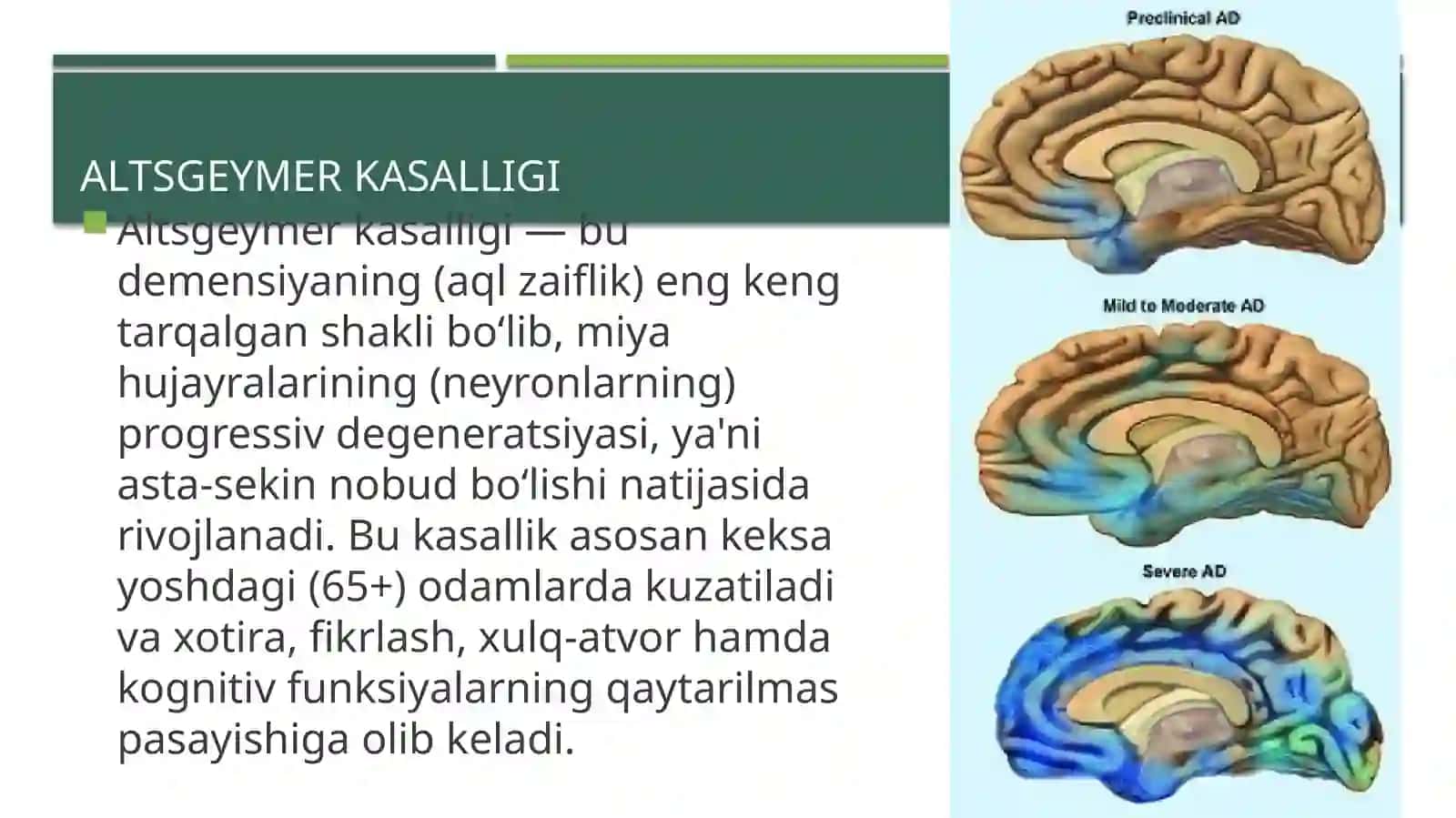 nerv sistemasining degenerativ kasalliklari 2