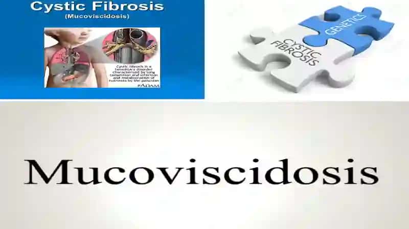MUKOVISSIDOZ 2