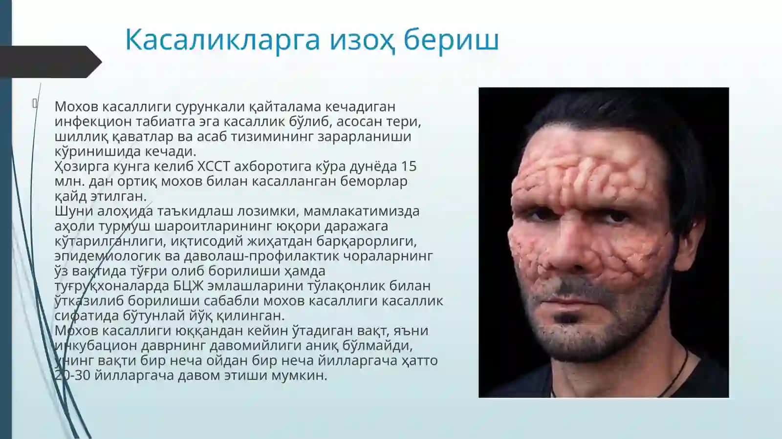 Мохов терининг паразитар касалликлари 2