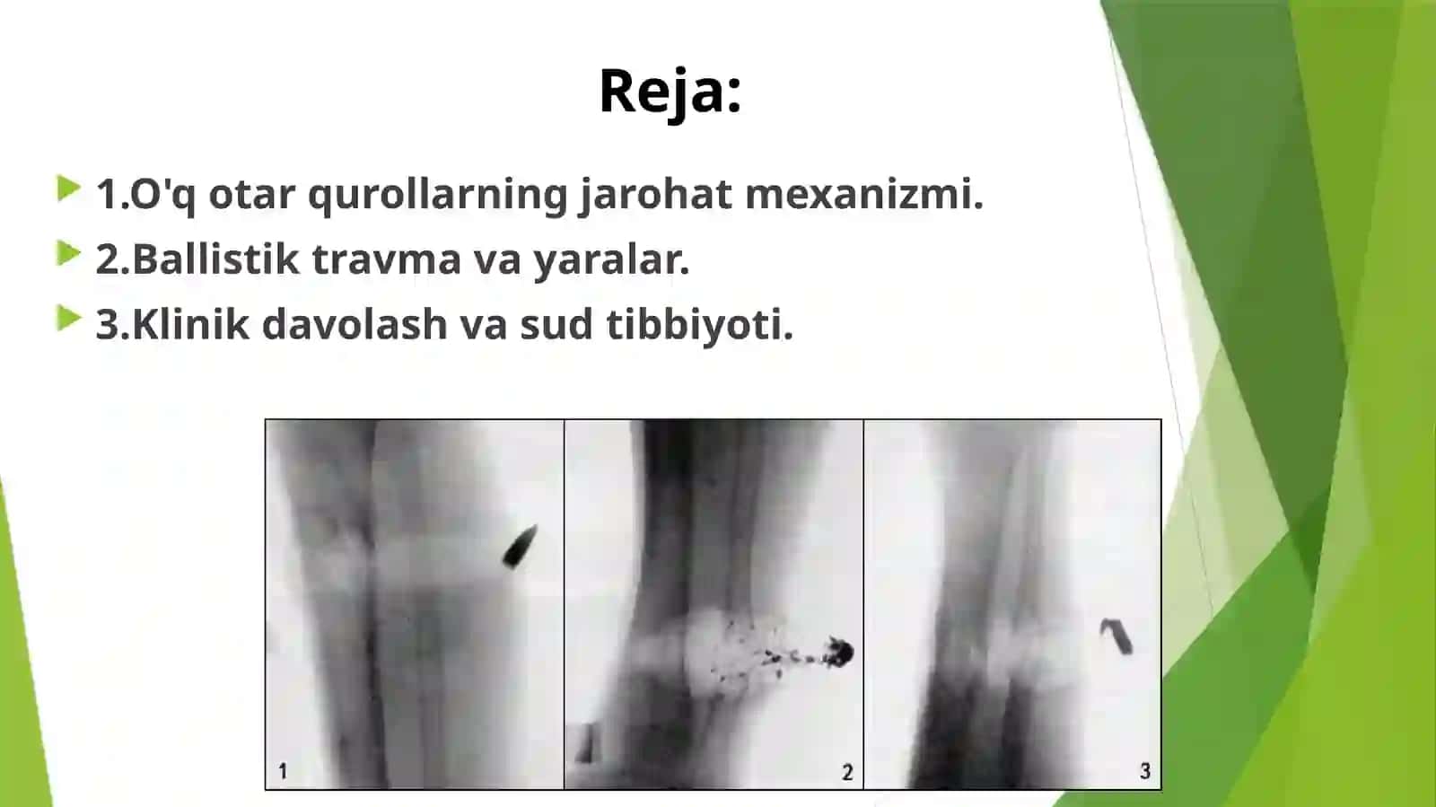 O‘qotar qurollardan jarohatlanish mexanizmi 2