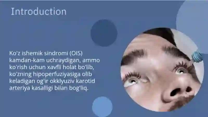 Og'ir ipsilateral yoki ikki tomonlama uyqu arteriyasi stenozi 2