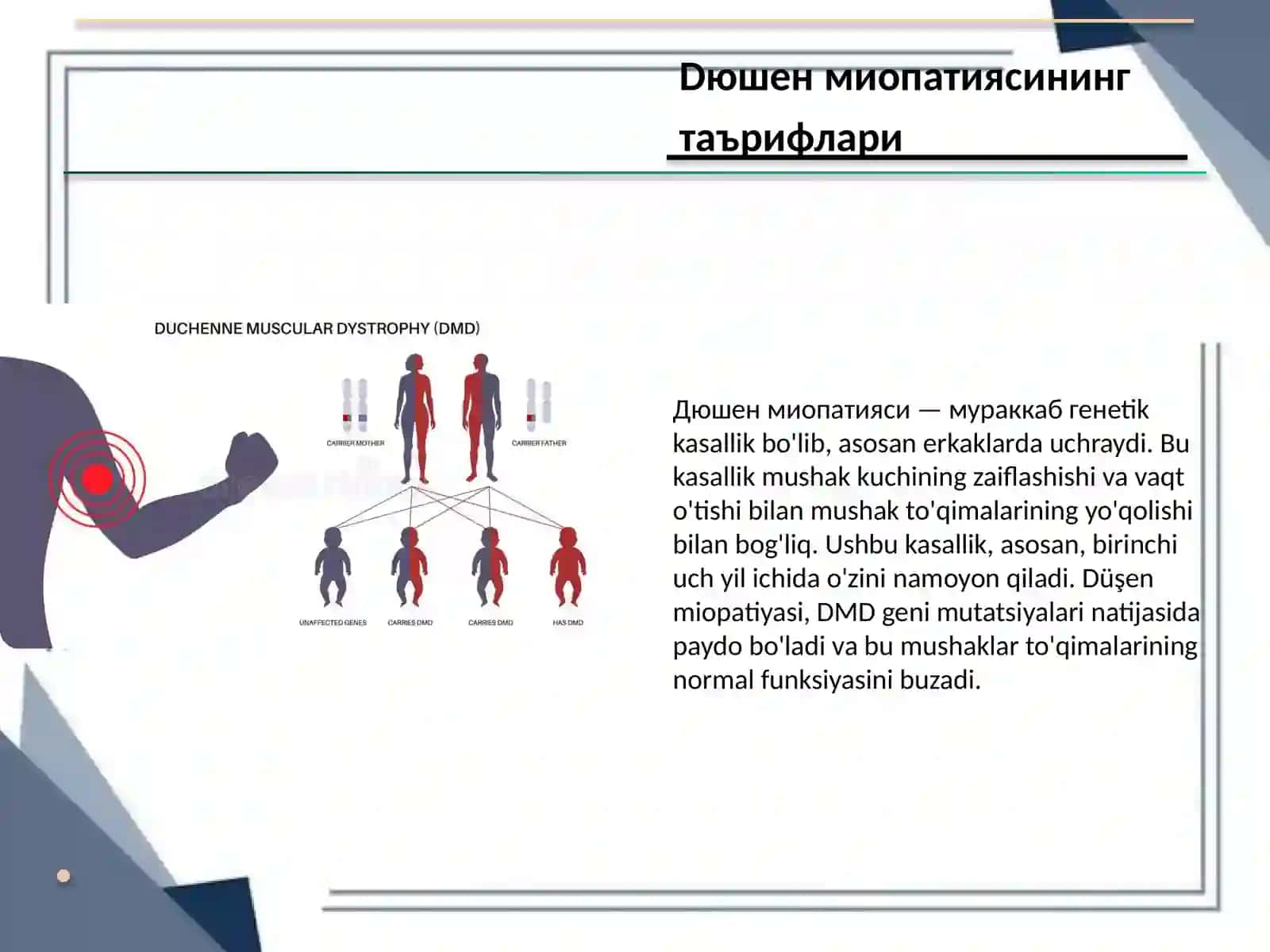 Дюшен миопатияси 2