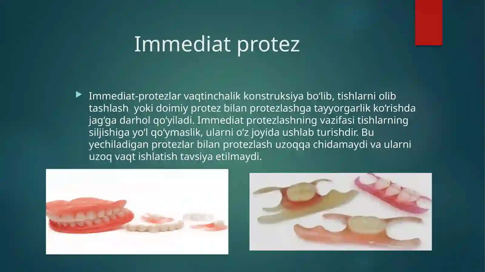 Immediat protez 2