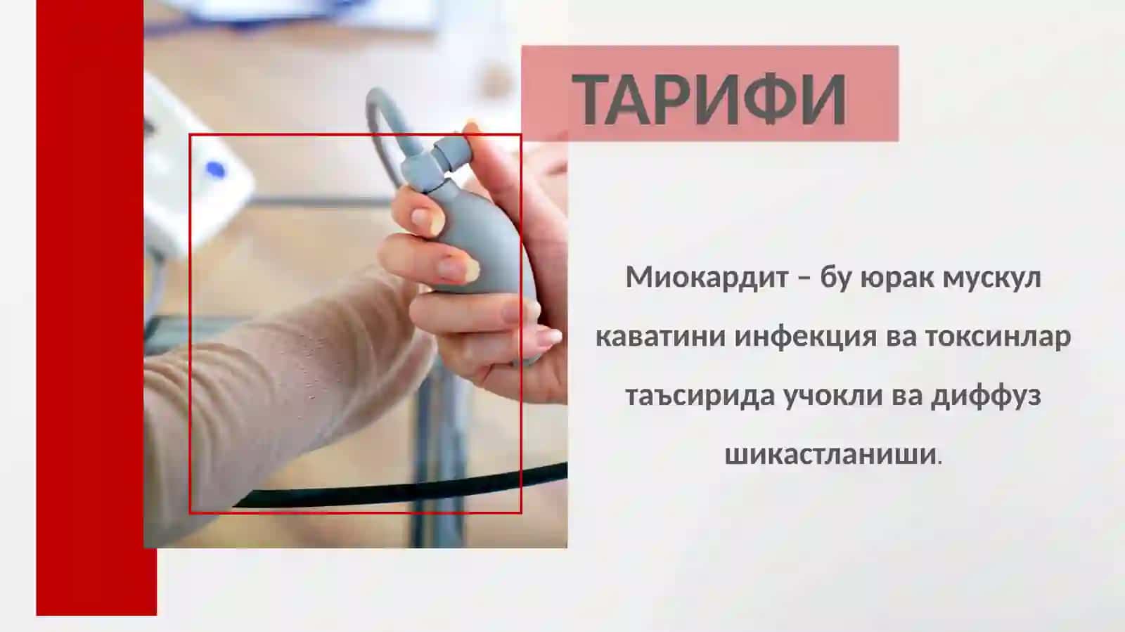миокардит 2026 2
