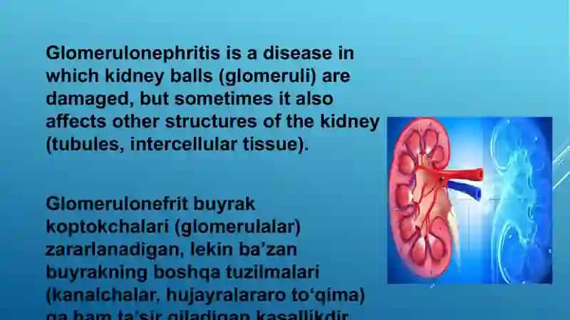 Glomerulonefrit 2