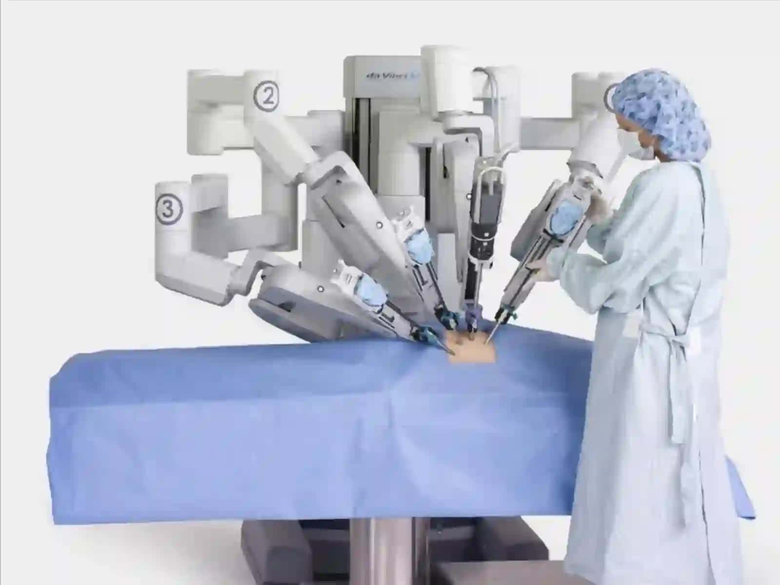 Robotlashtirilgan xirurgiya amaliyoti 2