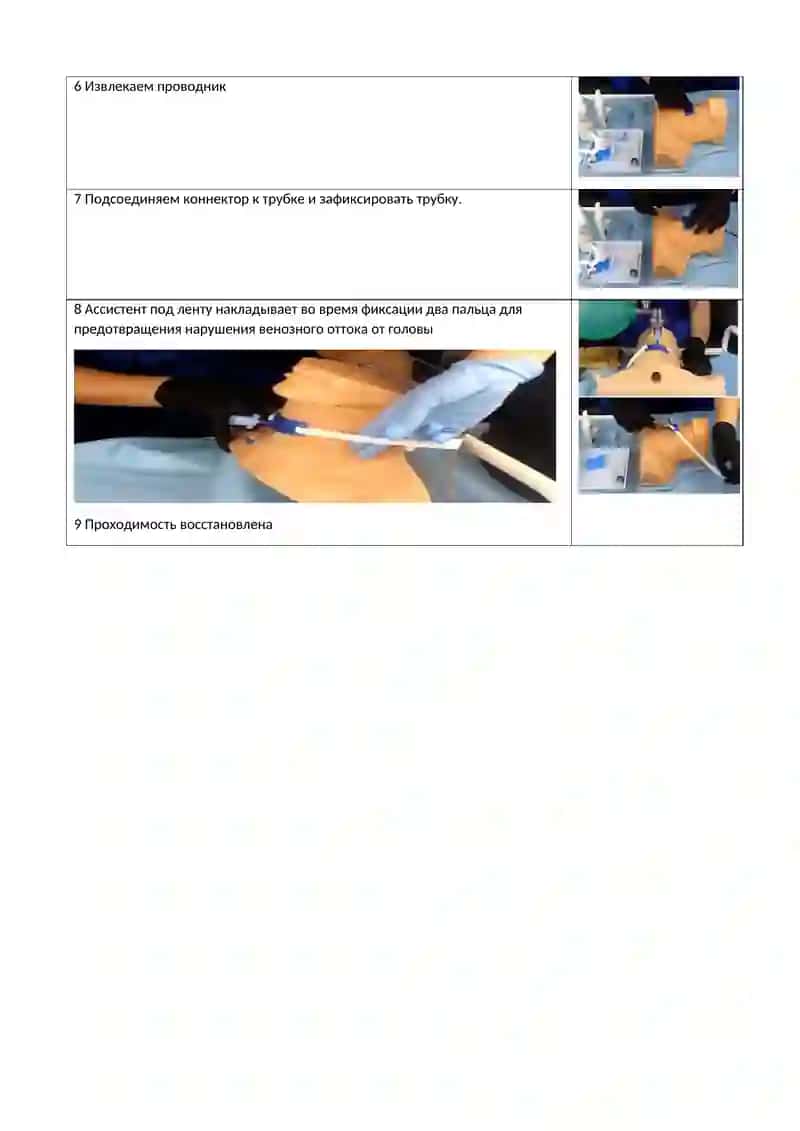 Коникотомия 2