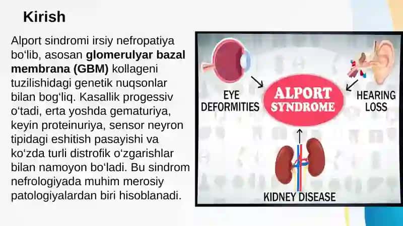 Alport sindromi 2