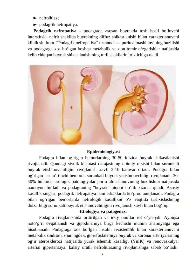 Podagrik ( uratli) nefropatiya 2
