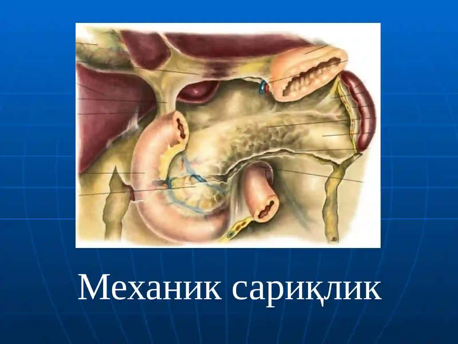 Механик сариқлик 2