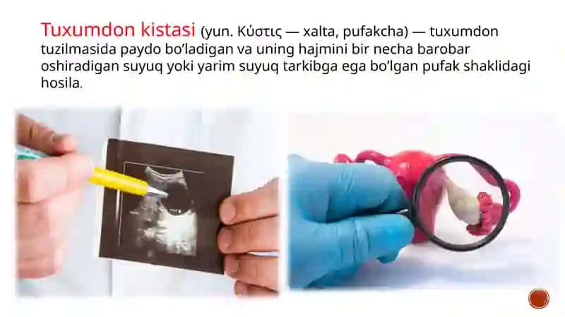 Tuxumdonkistasi 2