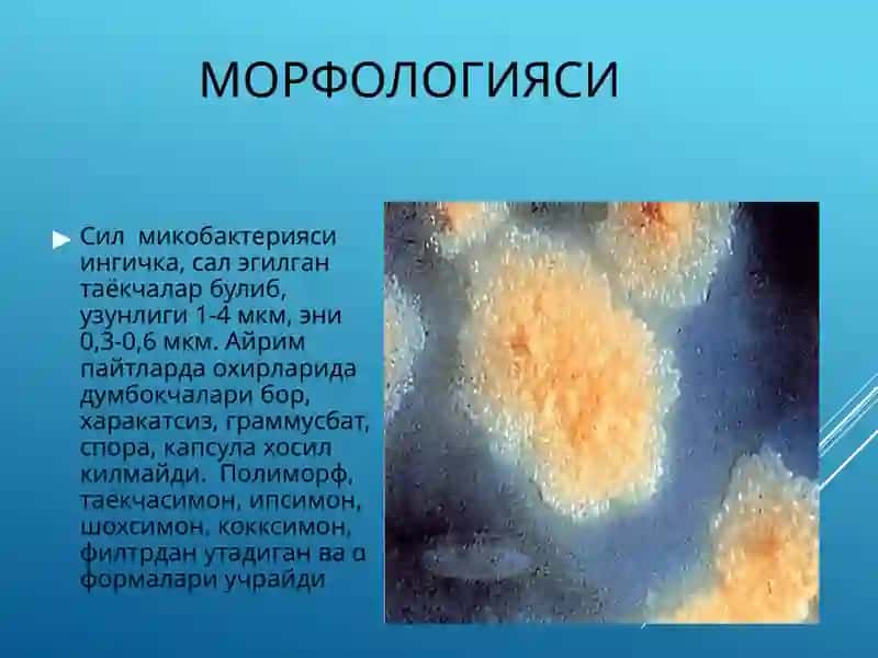 Туберкулез 2