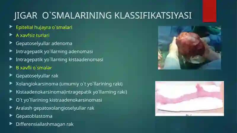JIGAR O`SMA KASALLIKLARI 2