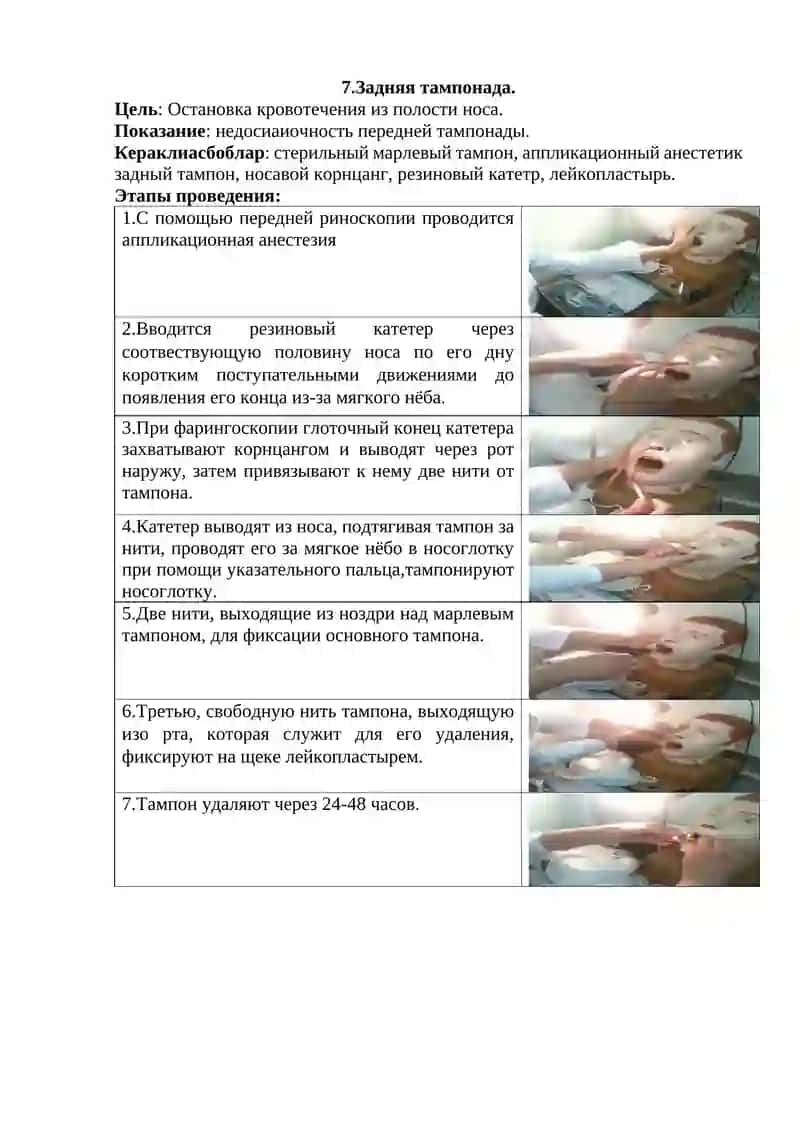 Передняя тампонада 2