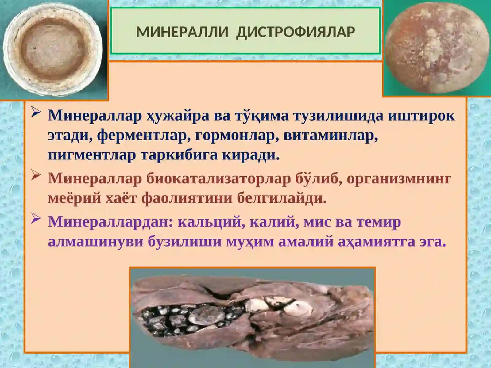 МИНЕРАЛЛИ ДИСТРОФИЯЛАР 2