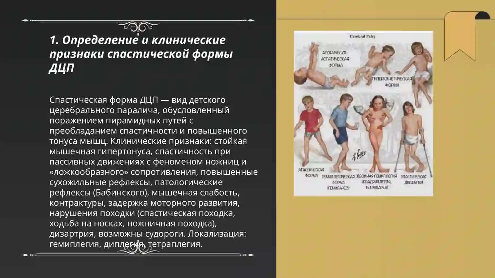 Спастическая форма ДЦП 3