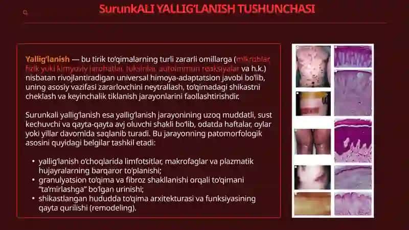 SURUNKALI YALLIG'LANISH 3