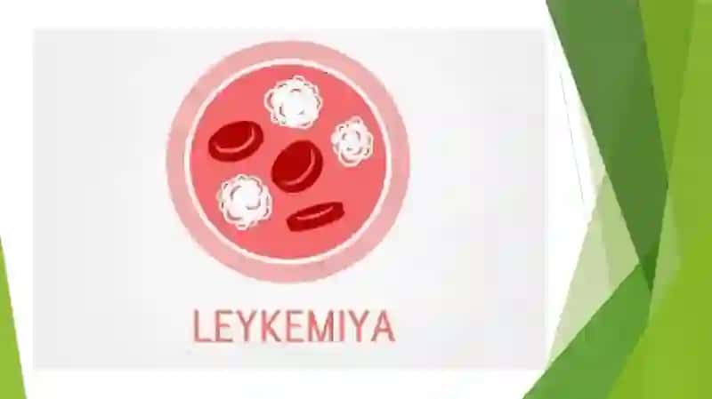 O’TKIR LEYKOZ LABORATOR DIAGNOSTIKASI 3