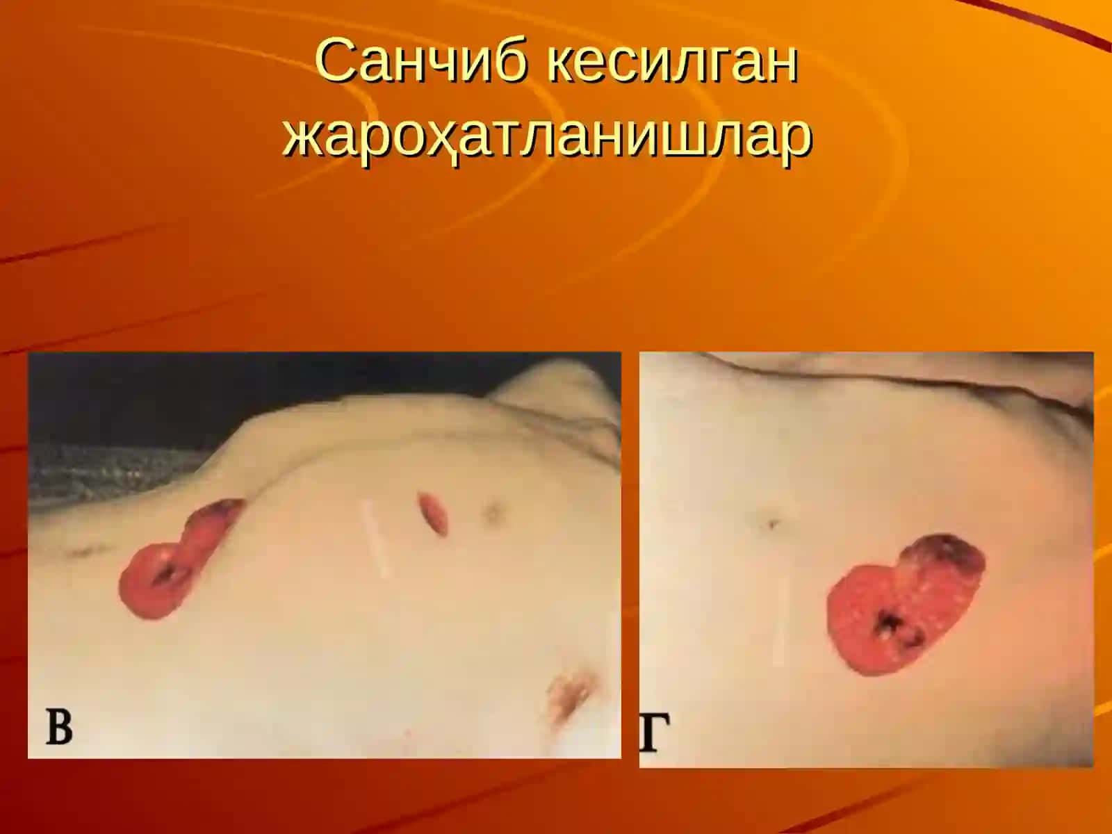 Жароҳатлар суд тиббий таснифи 3