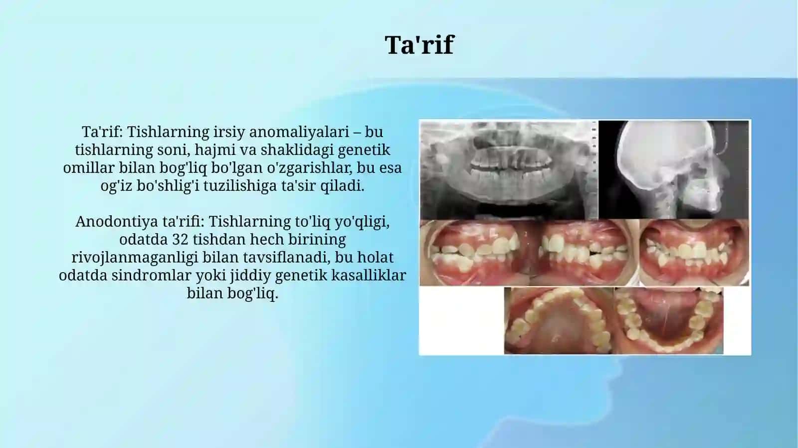 Tishlarning irsiy anomaliyalari 3