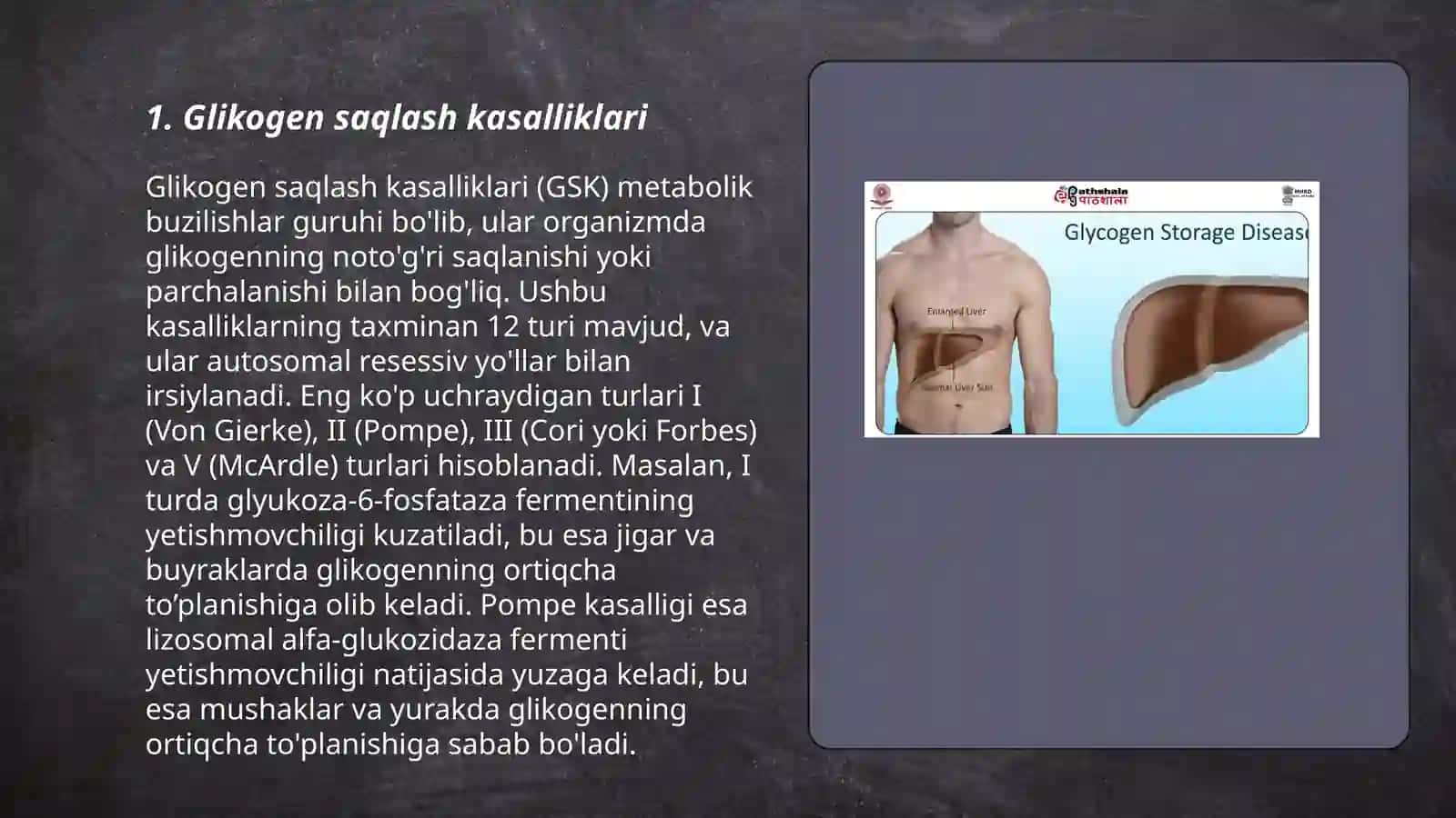 Glikogen kasalliklari 3