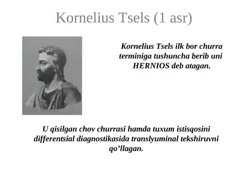 Qorin churralari va uning asoratlari 3