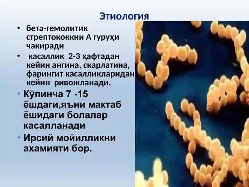 Ўткир ревматик иситма. 3