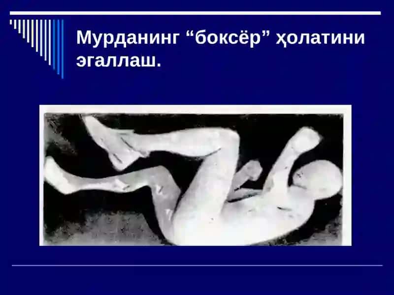 АЙРИМФИЗИК ЖАРОҲАТЛАР 3