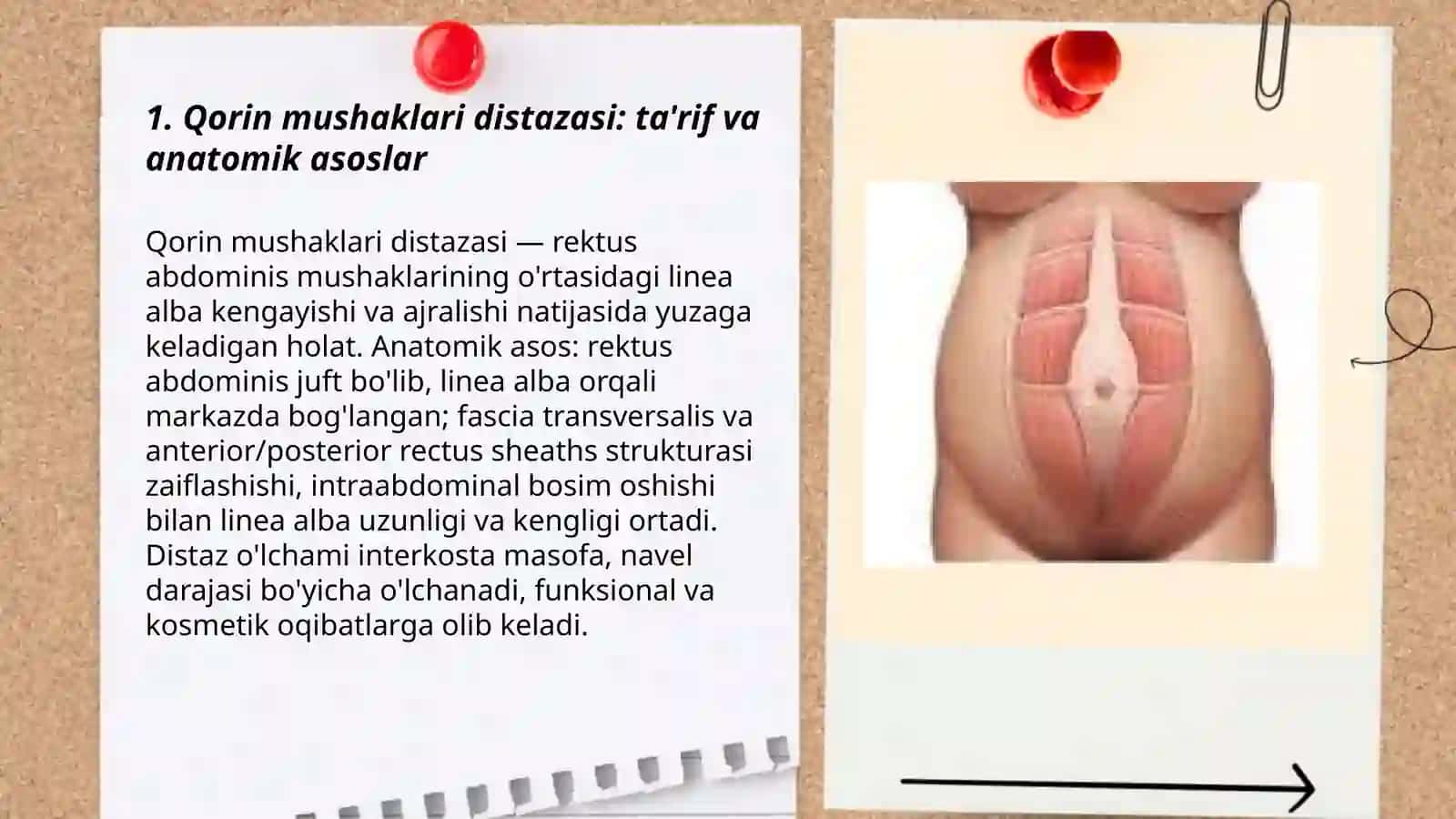 Qorin mushaklari distazasi 3