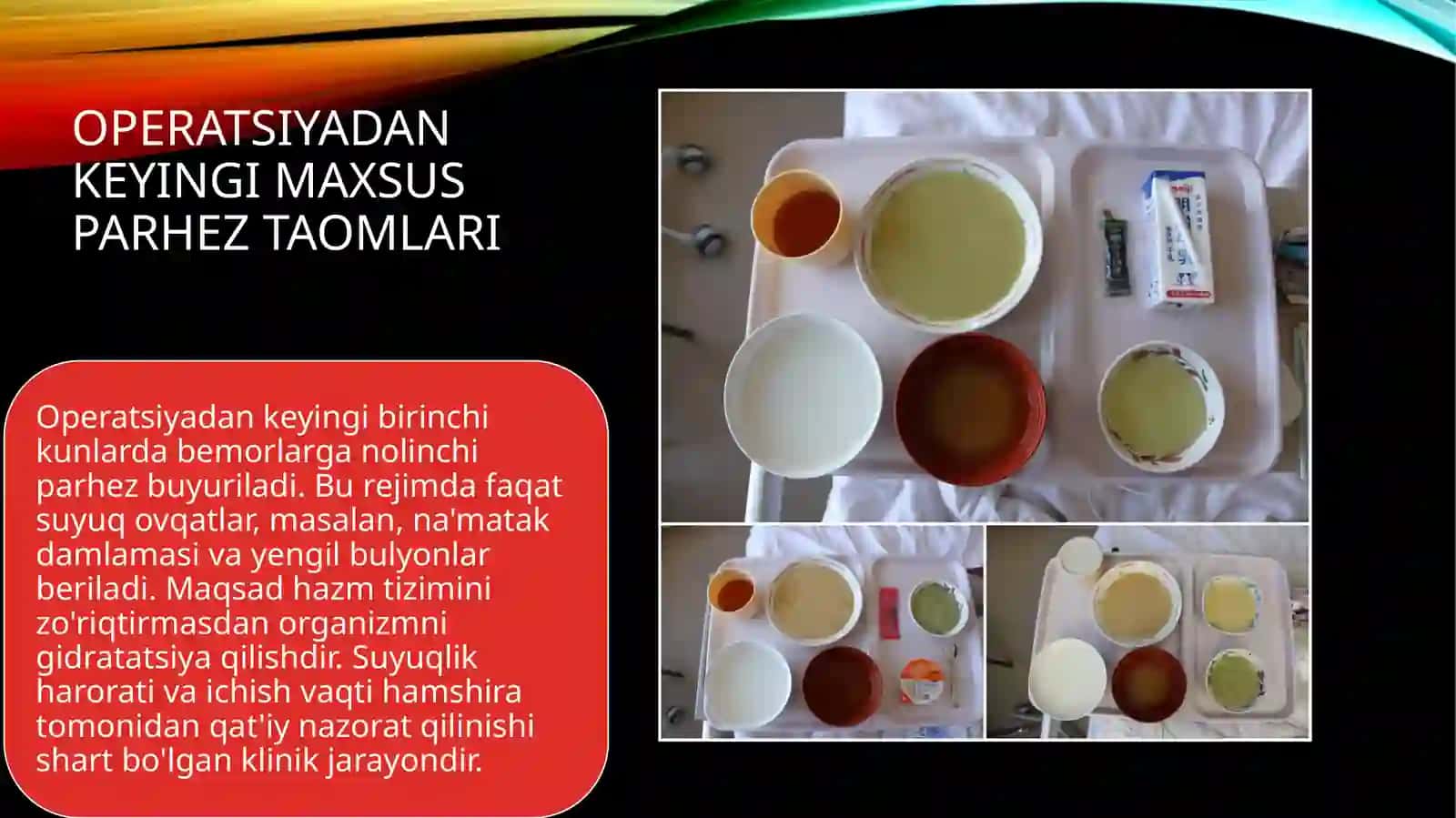 Xirurgik bo'limda ovqatlantirishni tashkillashtirish 3