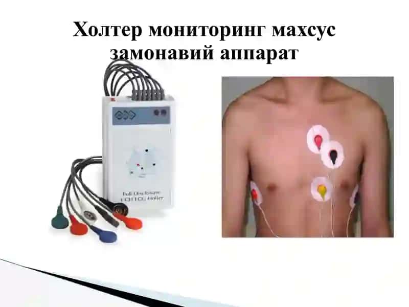 Холтер мониторинг 3