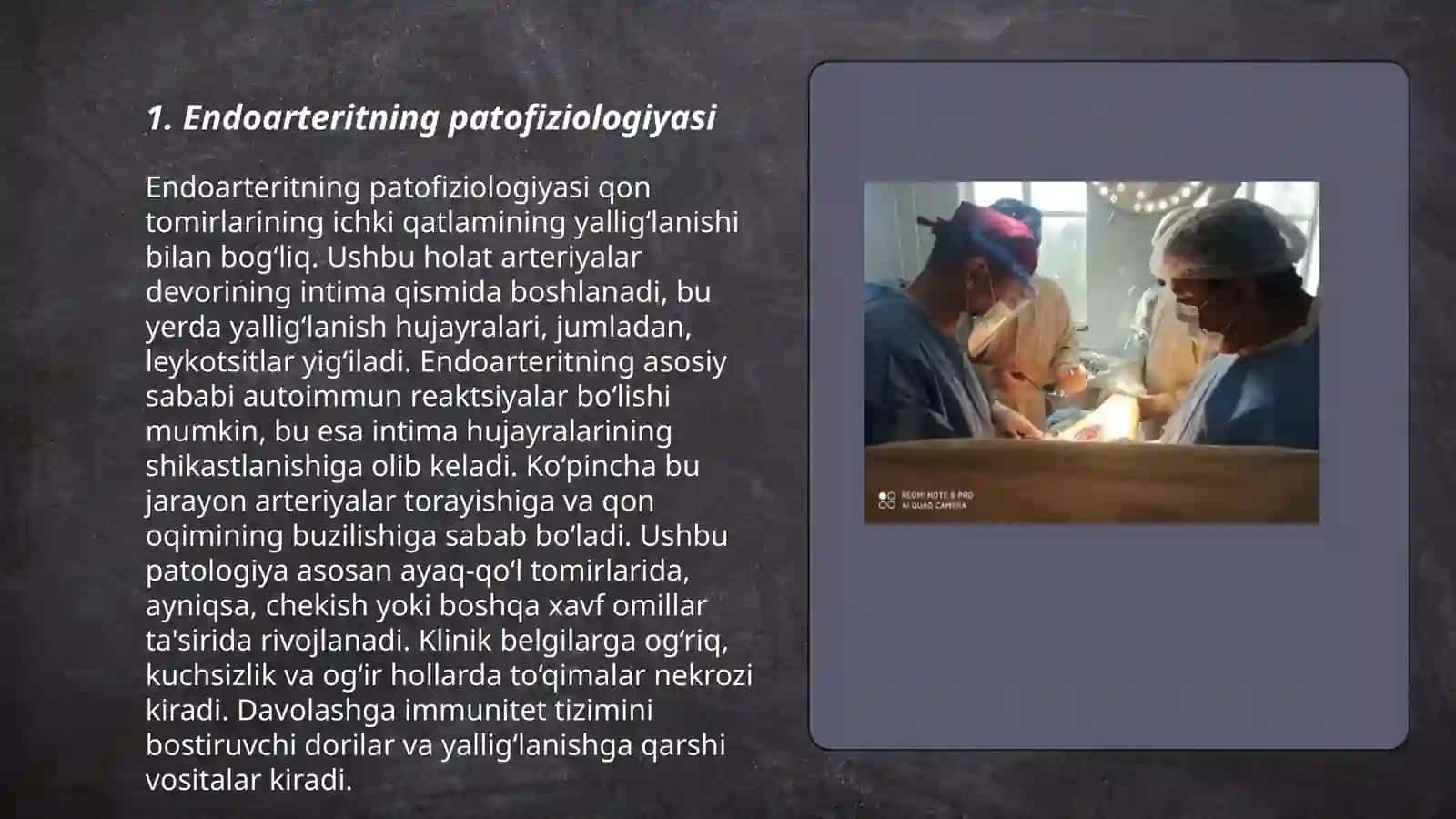 Endoarterit xastaligini davolashda rekonstruktiv operatsiyalar 3