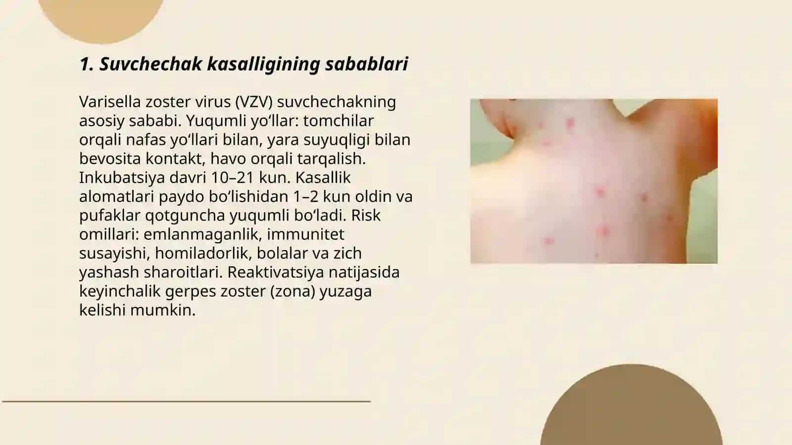 Suvchechak kasalligi 3