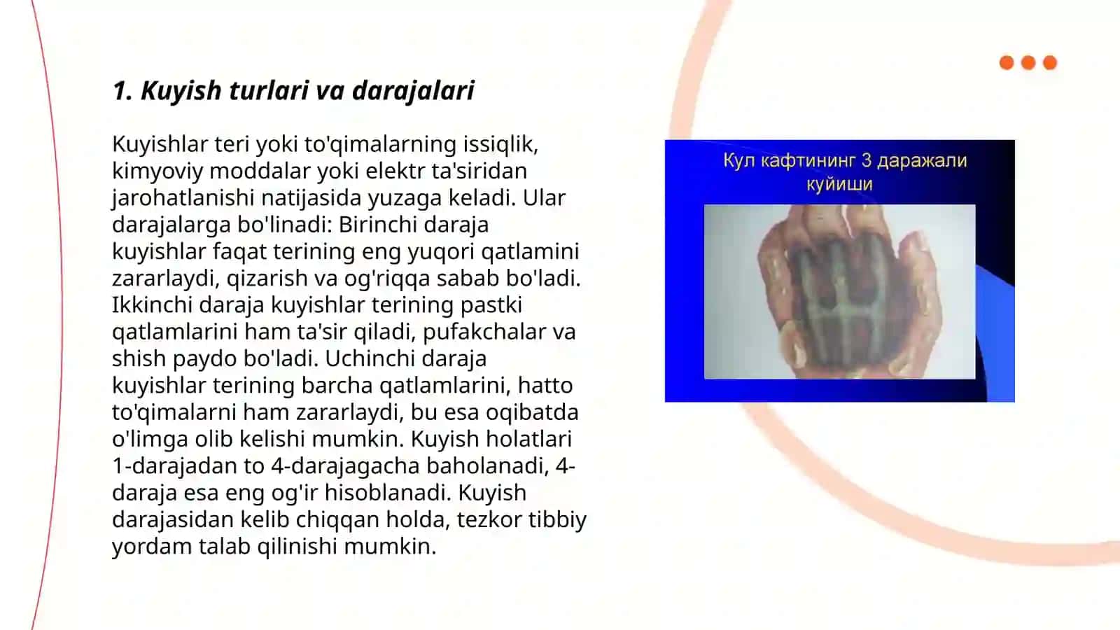 Kuyish, sovuq olishda hamshiralik ishi 3